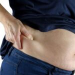 Cifras del sobrepeso y la obesidad