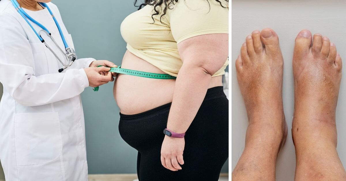 qué es, qué partes del cuerpo afecta y qué complicaciones puede haber si no se atiende correctamente Salud180